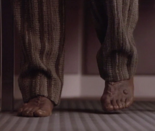 Worf's feet from "Ethics". They have a ridge running up the foot from his second toe, and a large protuberance over the outside of the foot.