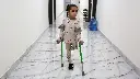 The Children Who Lost Limbs in Gaza