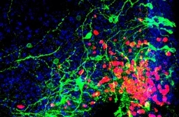 Newly discovered neurons change our understanding of how the brain handles hunger - News