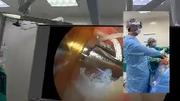 Orthopedic Doctor Uses Apple Vision Pro For Game-Changing Surgery Assist
